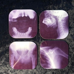 X-Ray Coasters - set of 4